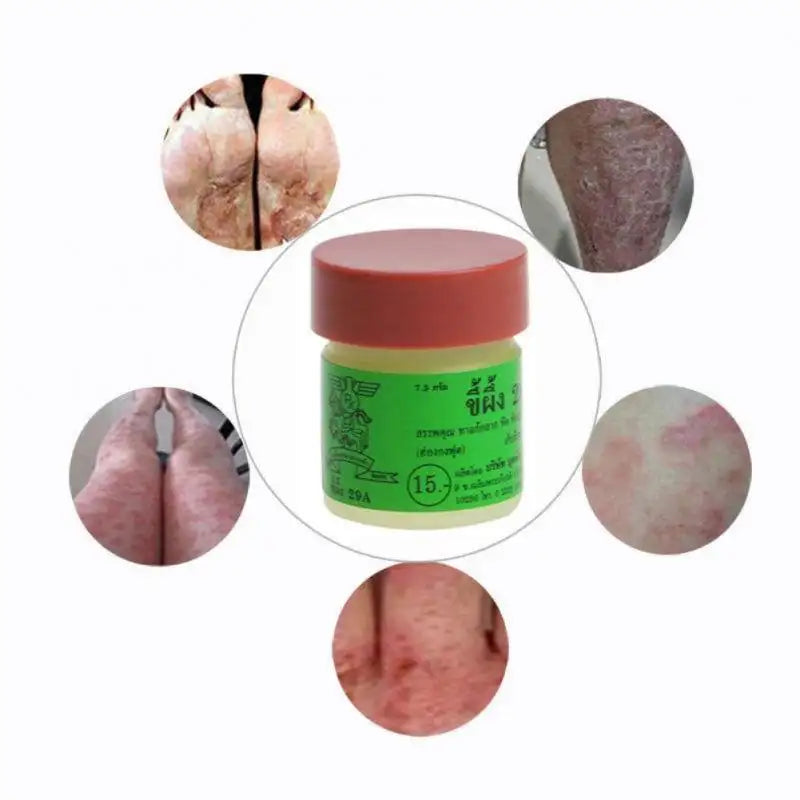 Thailand 29A ringworm ointment Natural Cream Works Really Well For Psoriasi Eczma Skin Care TSLM1