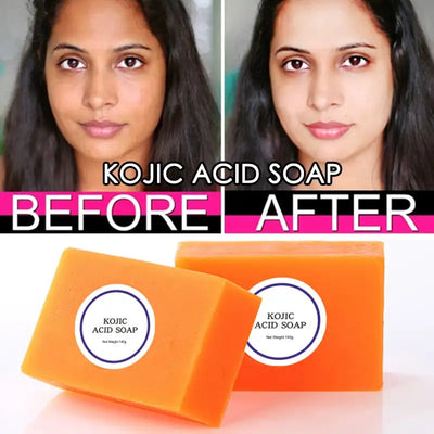100g Kojic Acid Soap Dark Black Skin Lightening Soap Hand made Soap Glutathione Whitening Soap Skin Bleaching Soap Brighten Face